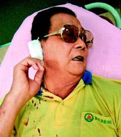 施松井遭屏东县议员卢同协丢石头击伤右耳。台湾《联合报》图