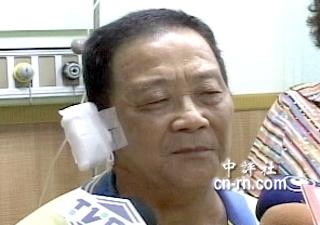 被民进党籍议员卢同协砸伤的灾民。电视截图